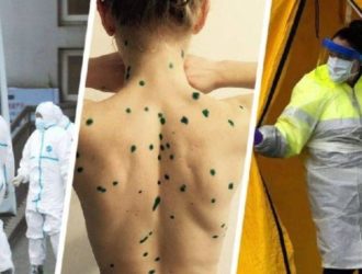 На европейских курортах начала распространяться оспа обезьян: выявлены заразные туристы